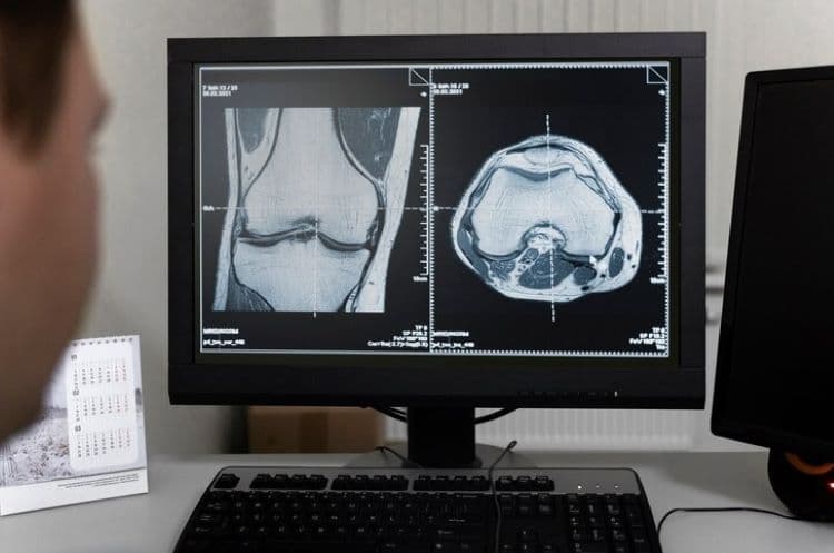 Waspadalah! 7 Tanda Anda Kekurangan Asupan Vitamin K dalam Diet Harian, Menurut Dokter - Image