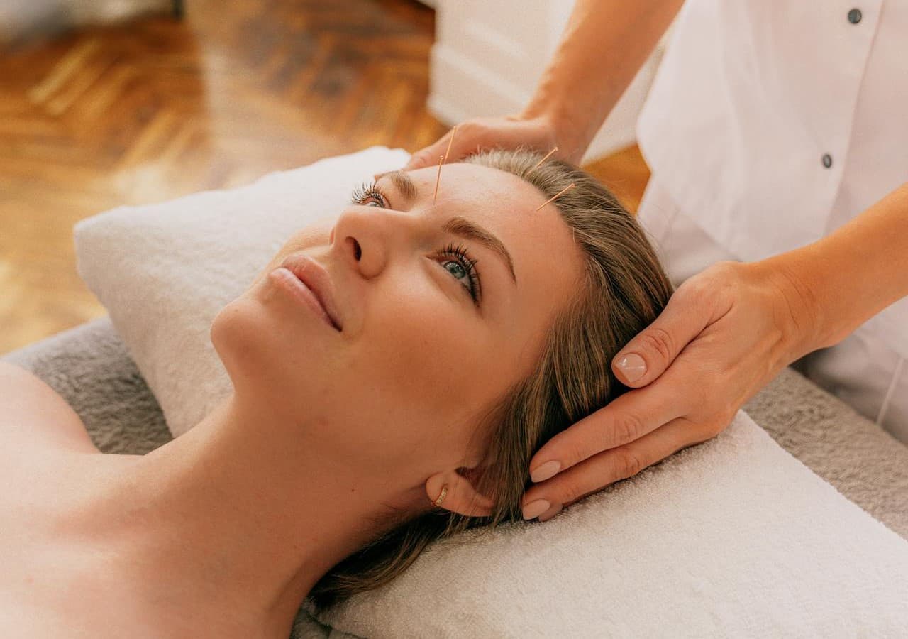 Akupunktur untuk kecantikan: Tren Baru Terbukti Ilmiah Bantu Wajah Awet Muda - Image