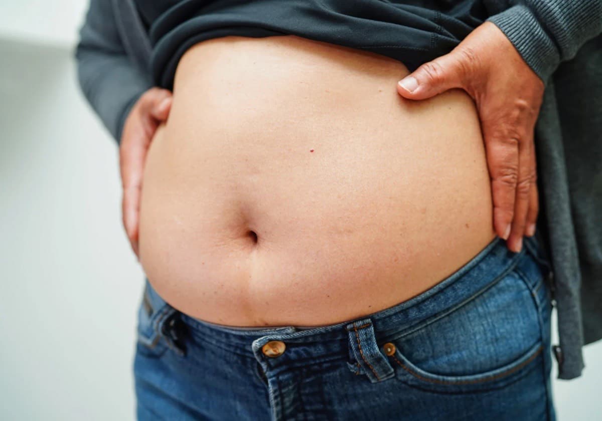 9 Penyebab Perut Buncit yang Harus Diketahui, Salah Satunya Kurang Aktivitas Fisik - Image