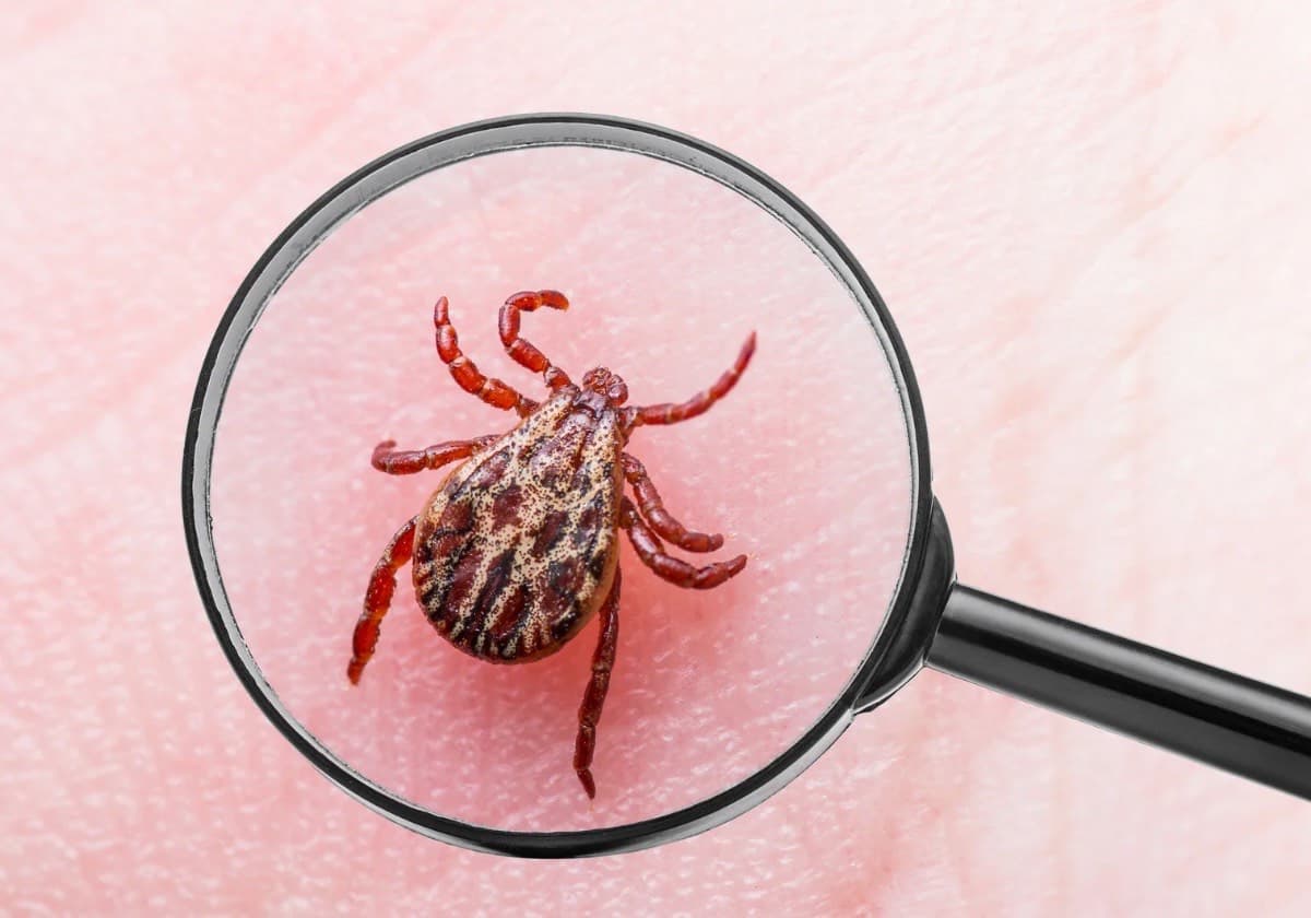 Penyakit Lyme: Penyebab, Gejala, dan Cara Pengobatannya yang Perlu Diketahui - Image