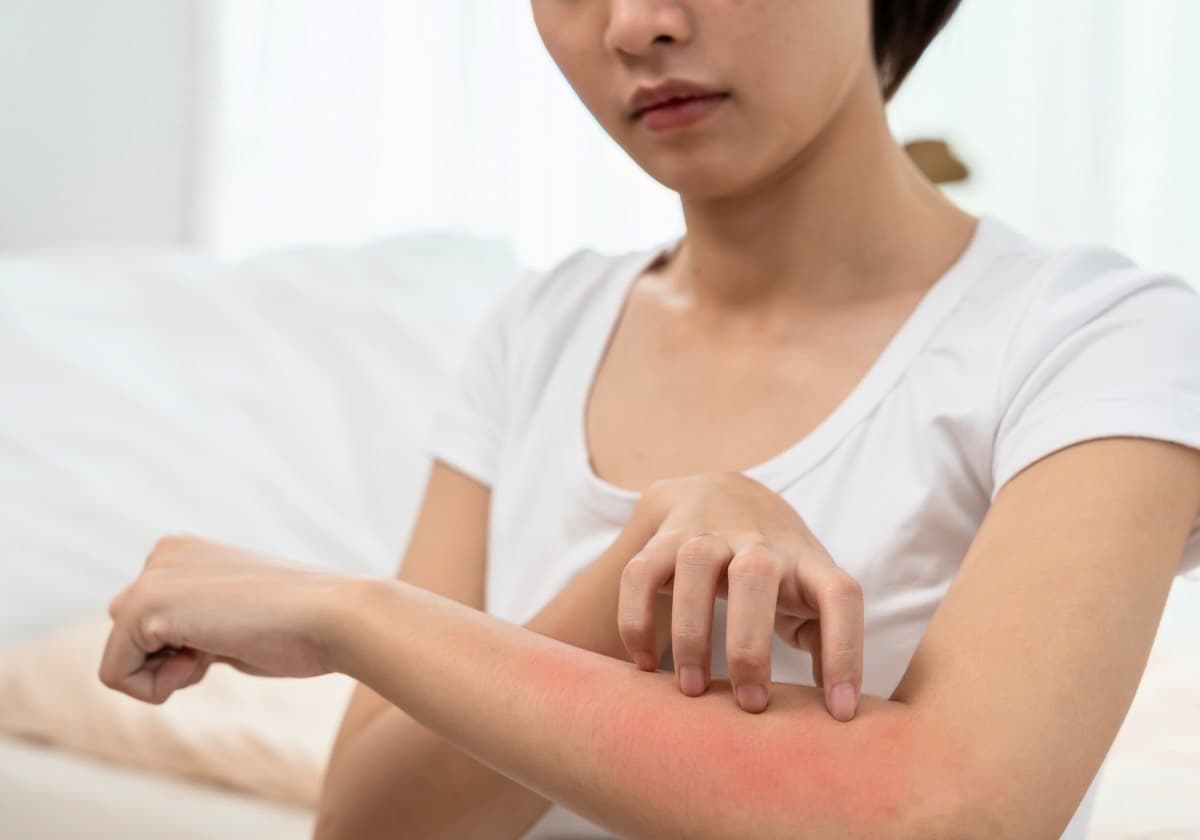 8 Ciri-ciri Penyakit Kulit yang Mudah Dikenali, Waspadai Sejak Sekarang Sebelum Terlambat - Image