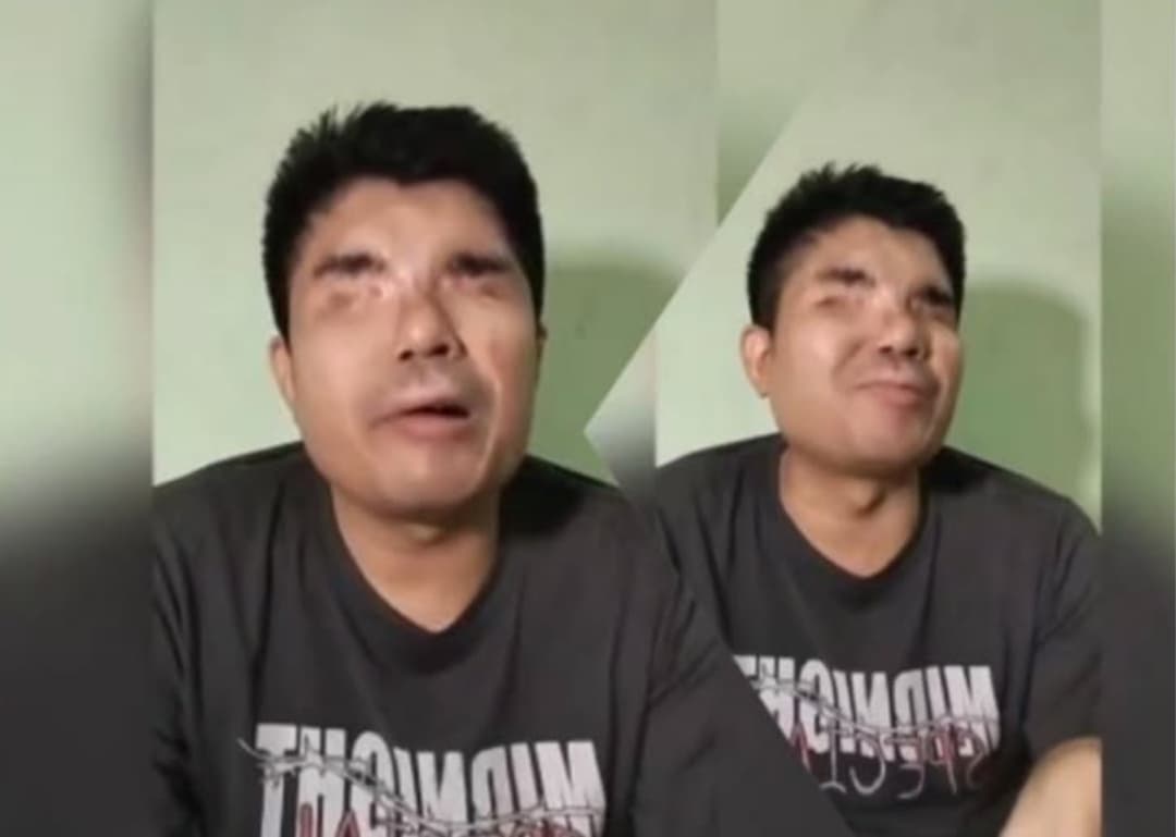 Balada Agus Salim, Korban Penyiraman dengan Air Keras, Kini Ditinggal Istri - Image