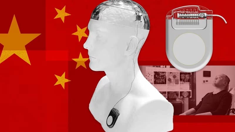 Tiongkok Dorong Industri Implan Otak sebagai Sektor Strategis untuk Menyaingi Neuralink Elon Musk - Image