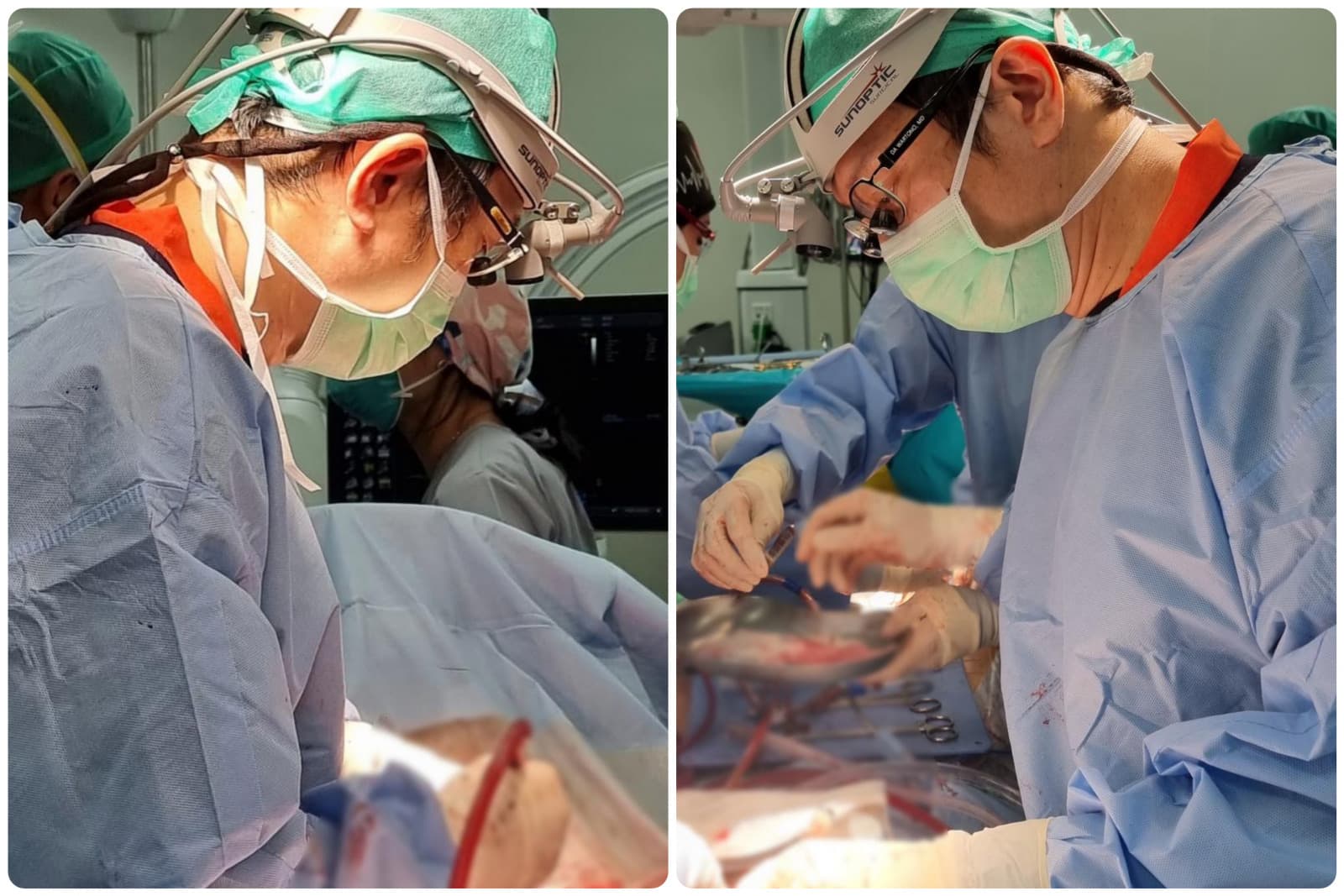 Penyakit Kardiovaskular Menjadi Salah Satu Penyebab Kematian Terbanyak, Teknologi Terkini untuk Deteksi Awal Dibutuhkan - Image